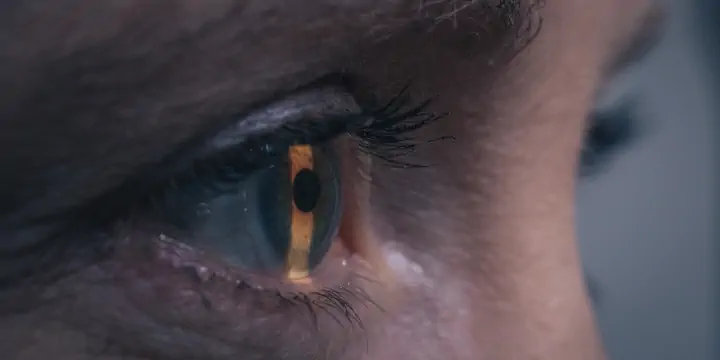 Kontaktlinsenanpassung